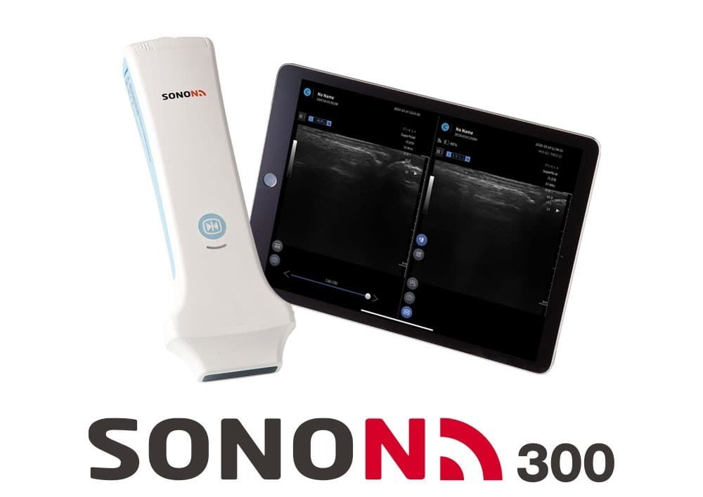 SONON